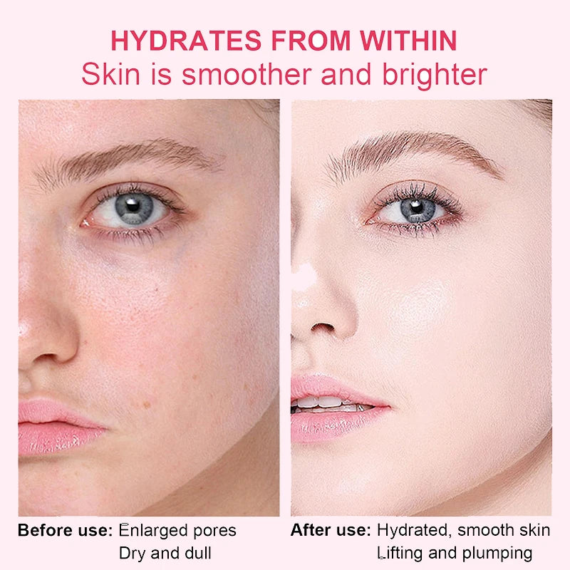 Niacinamide Moisturizer