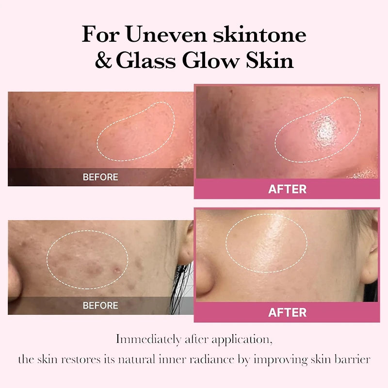 Niacinamide Moisturizer