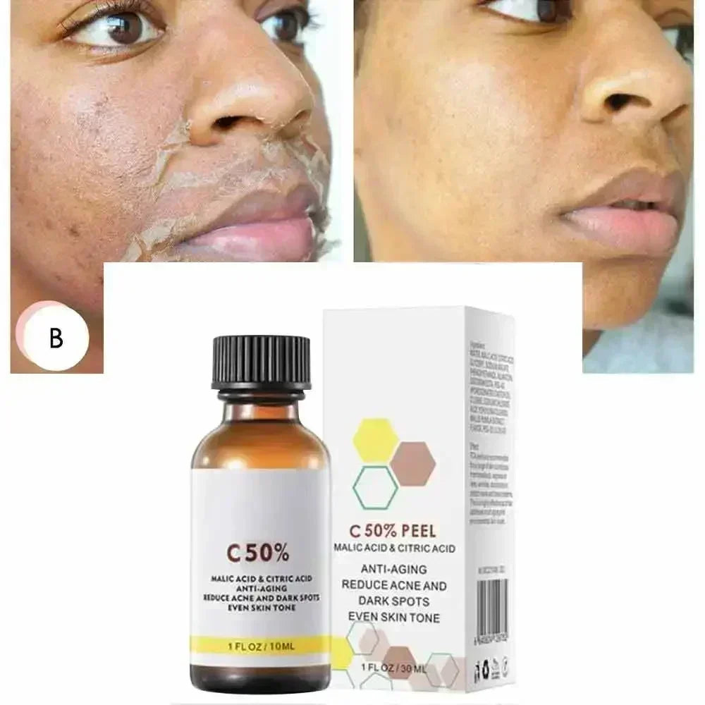40% Malic–Citric Facial Peel Serum