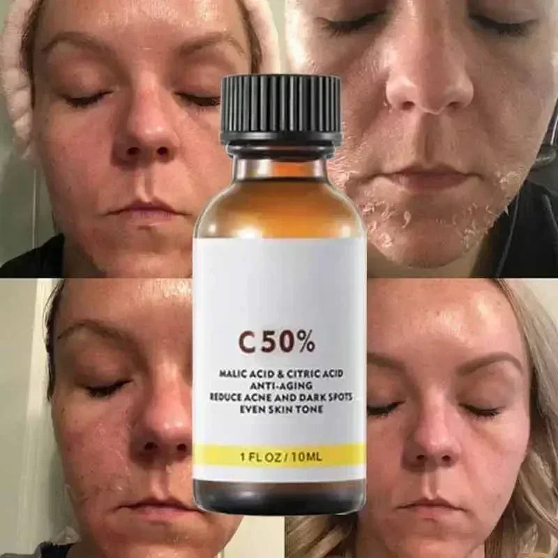 40% Malic–Citric Facial Peel Serum