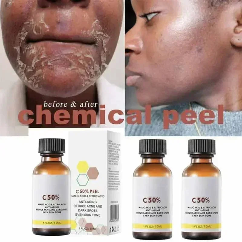 40% Malic–Citric Facial Peel Serum